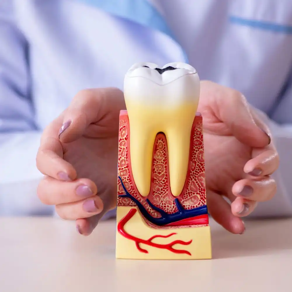 Root Canal Treatment